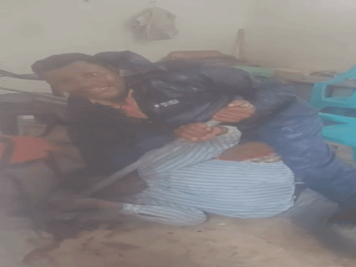दफ्तर में घुसकर पटवारी पर रॉड से हमला, सिर में लगी चोट; वीडियो वायरल